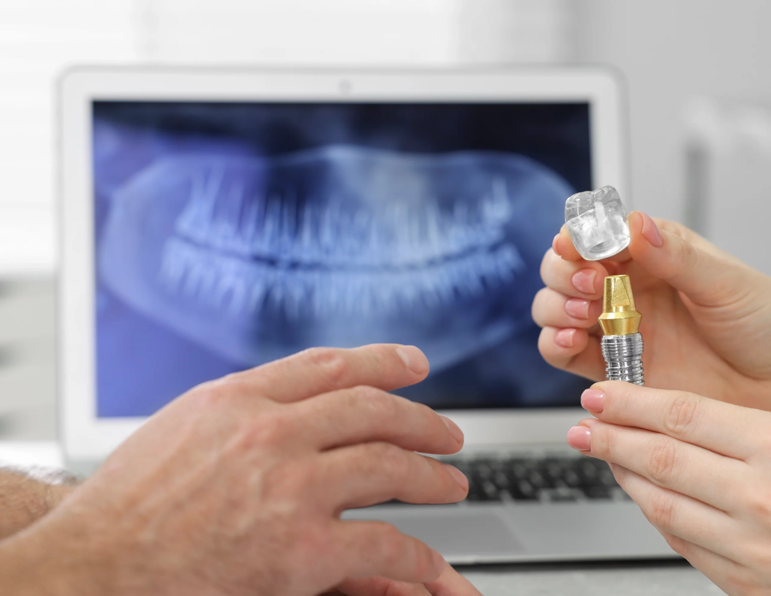 Patient consultation for dental implants at Enhance Dental Dublin clinic