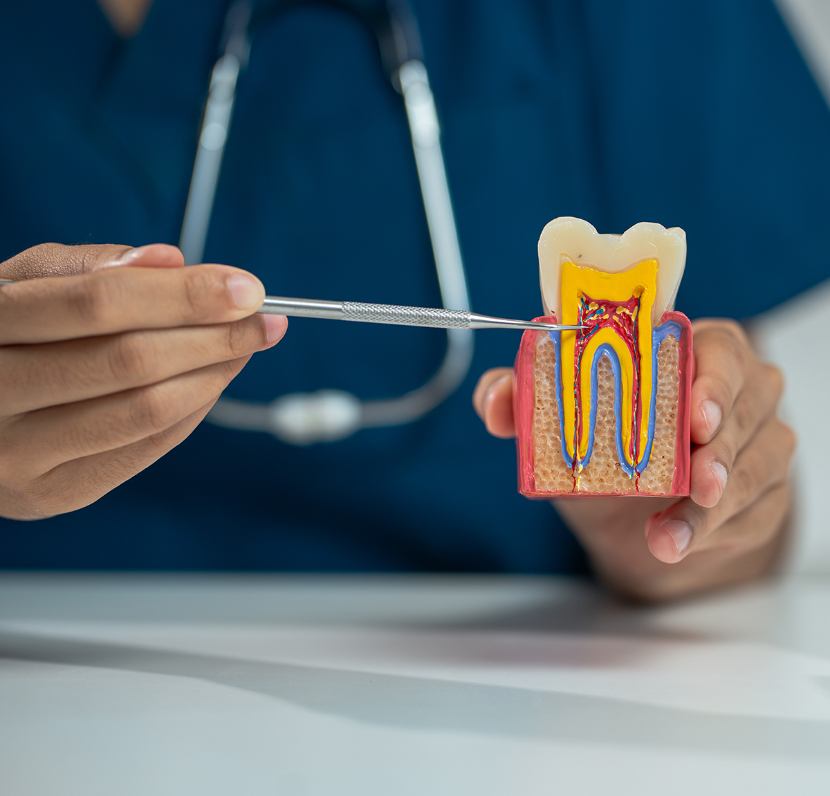 Root canal treatment Dublin — Enhance Dental Dublin 1