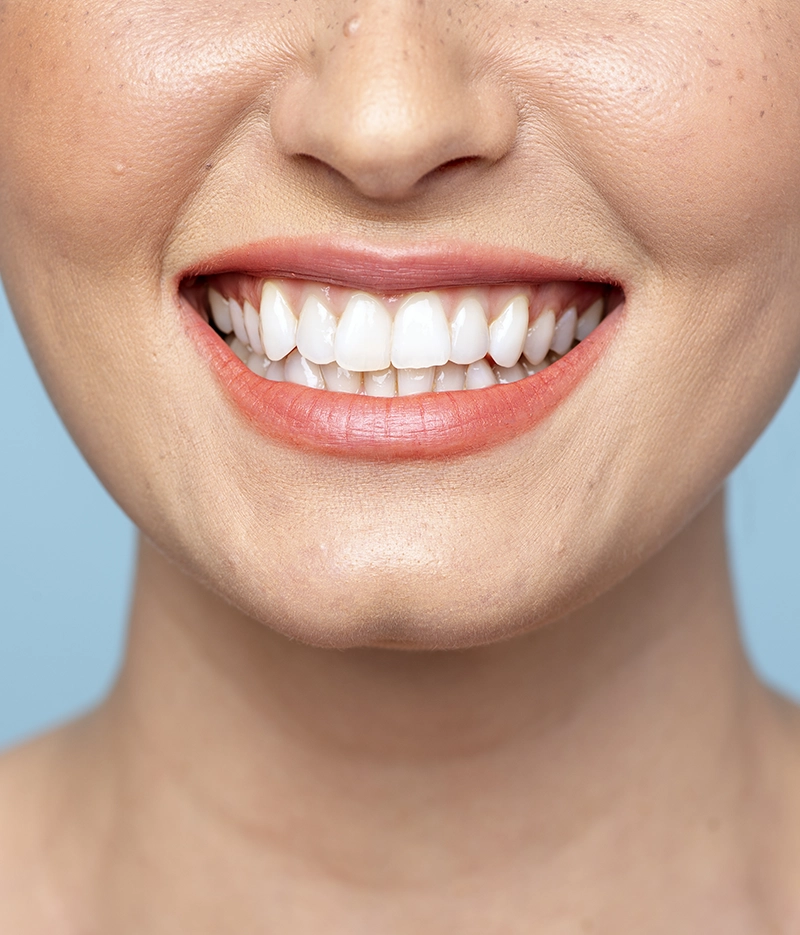 Dental cleaning results Dublin Enhance Dental