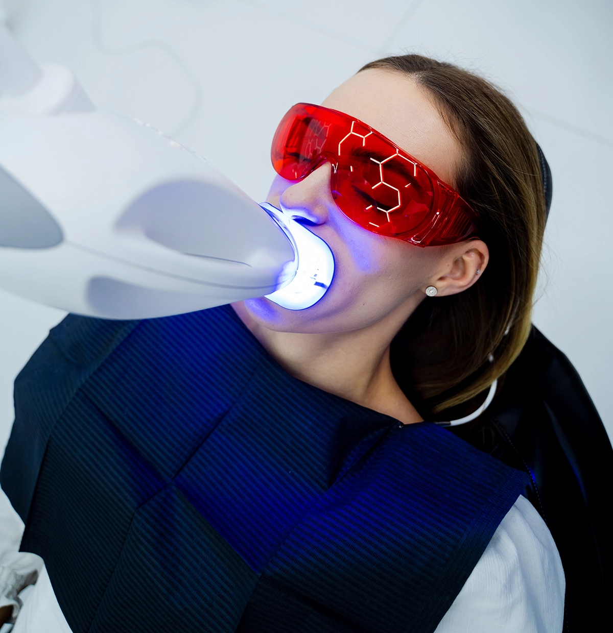 Teeth whitening Dublin — Enhance Dental Dublin 1